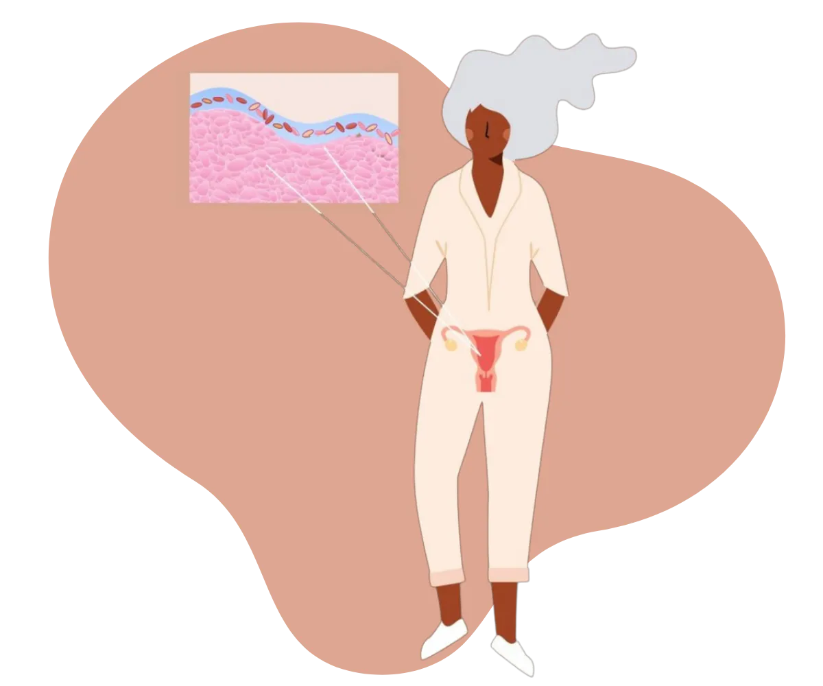illustration of woman and the vaginal microbiome