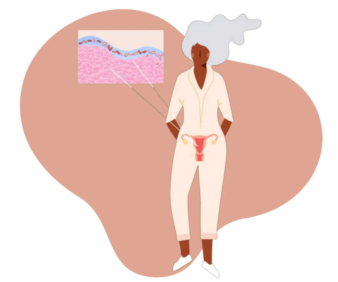 illustration of woman and the vaginal microbiome