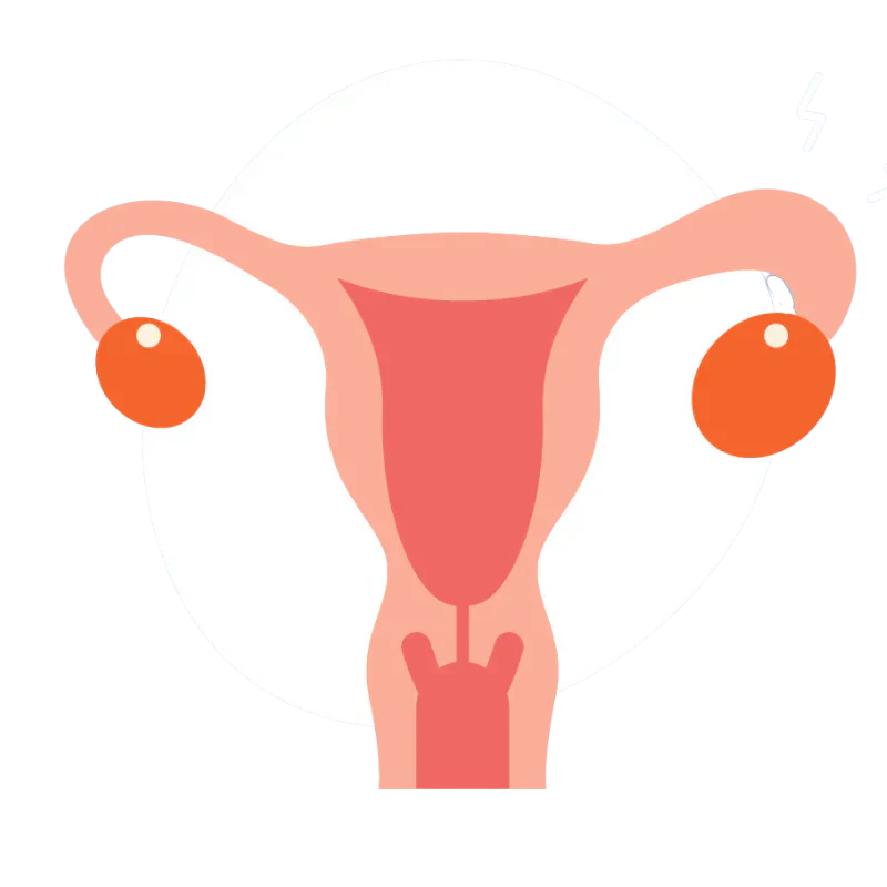 Uterus with Endometriosis
