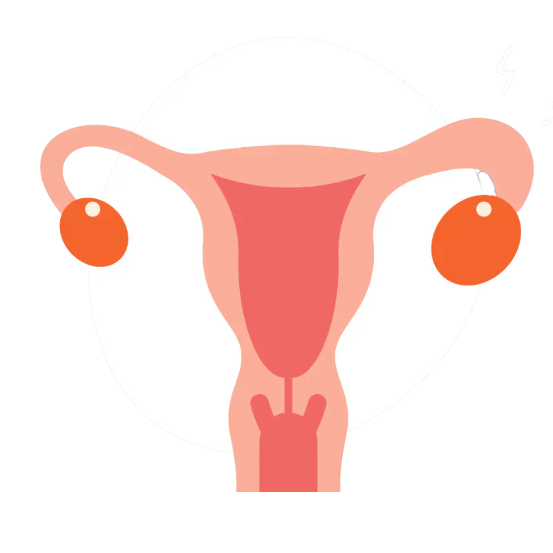 Uterus with Endometriosis